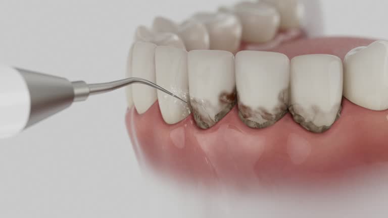 Reliable Teeth Cleaning And Checkup contractor in Pickens County County, AL by Dentist Open Now